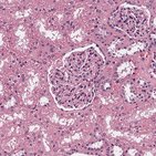 Kidney: Nephron and juxtaglomerular apparatus