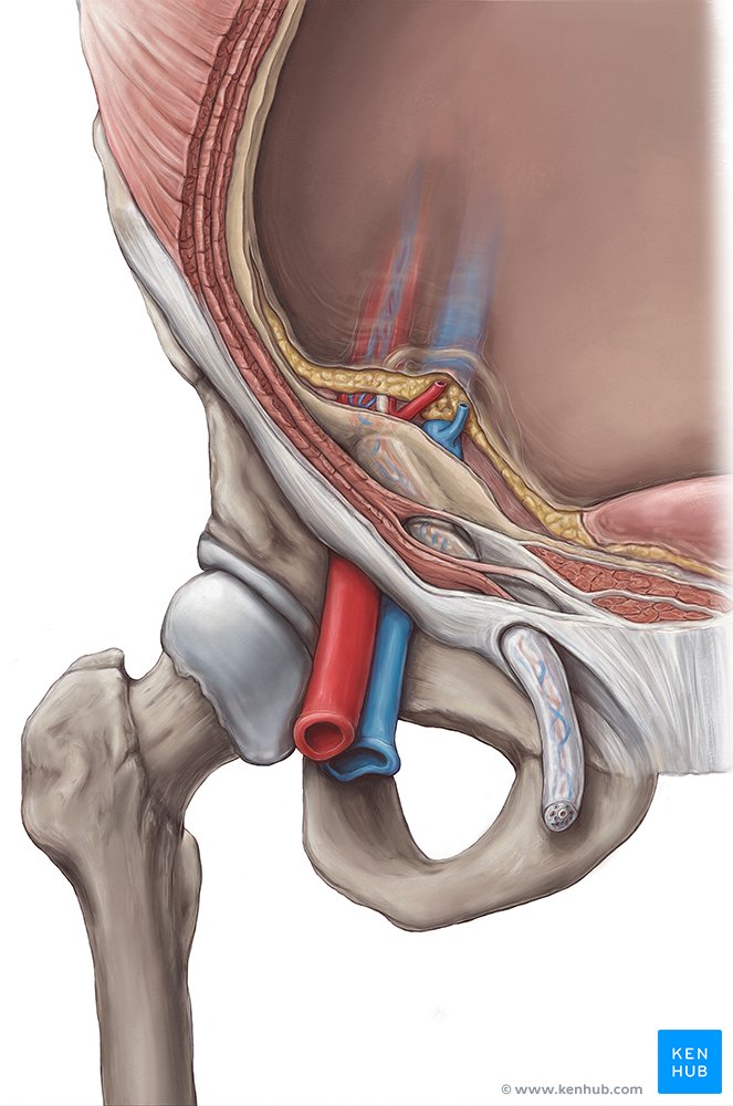 Orificio inguinal interno deals