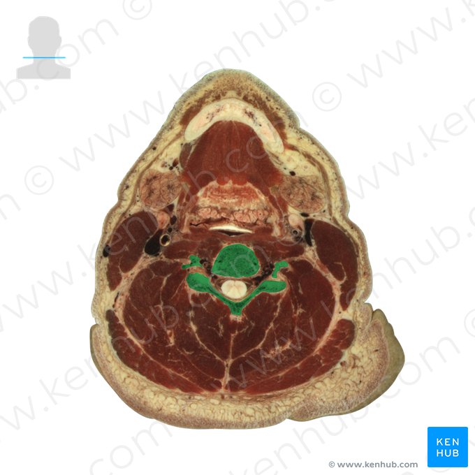 Vertebra C4 (Wirbel C4); Bild: National Library of Medicine