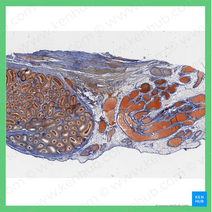 Epidídimo (Epididymis); Imagem: 