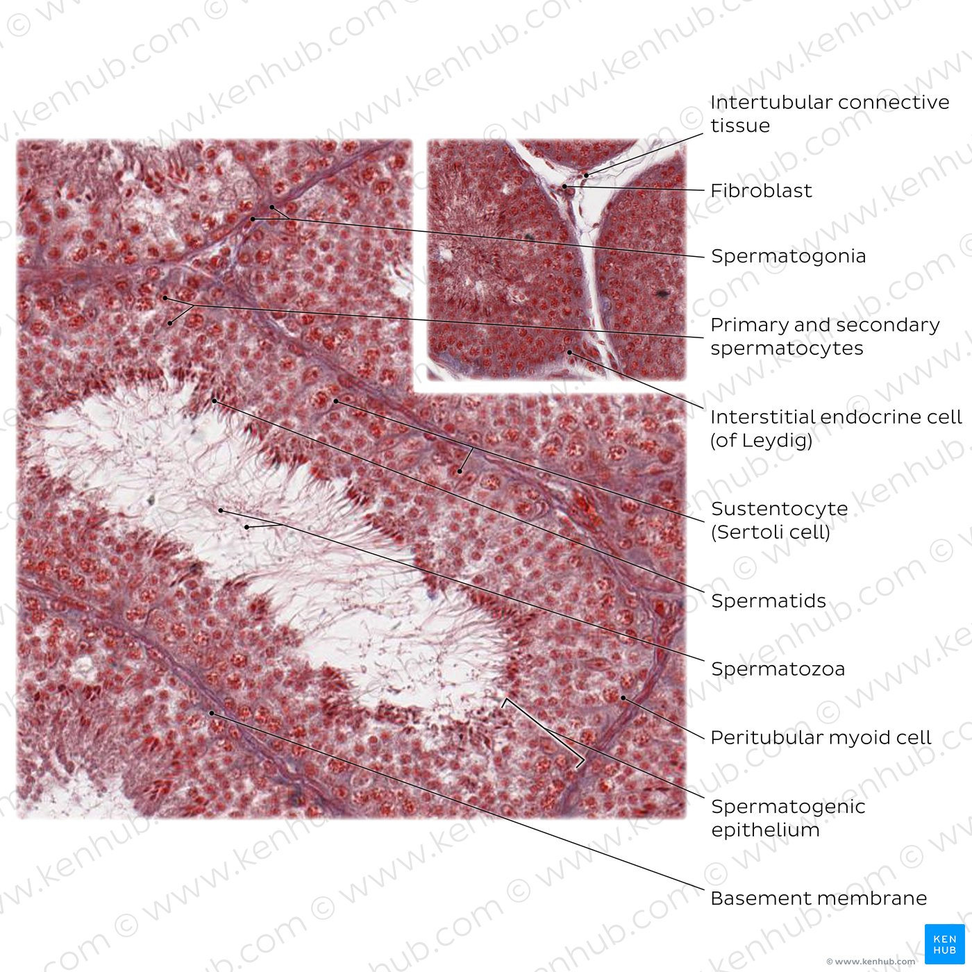 Convoluted seminiferous tubule. Stain: Ladewig's trichrome. High magnification.