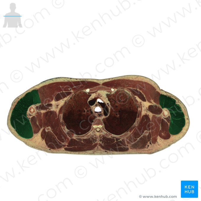 Musculus deltoideus (Deltamuskel); Bild: National Library of Medicine