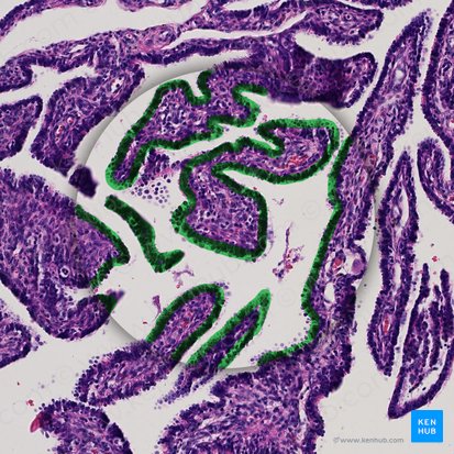 Epithelium simplex columnare kinociliatum (Einschichtig hochprismatisches Epithel (mit Kinozilien)); Bild: 