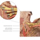 Clinical case: Brachial plexus injury