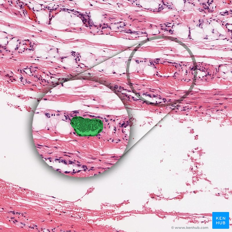 Vasa vasorum - histological slide