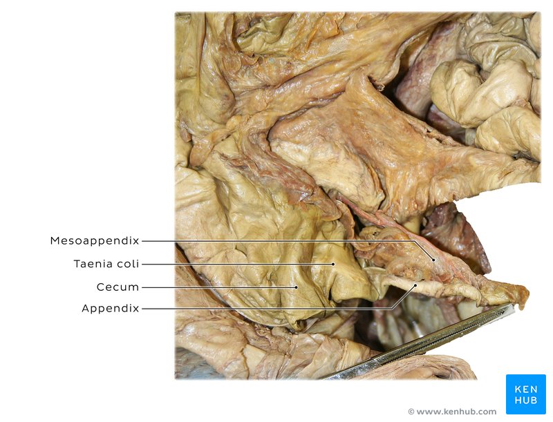 Vermiform Appendix - magnified