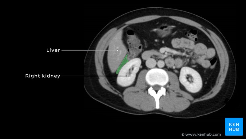 Hepatorenal pouch of Morison