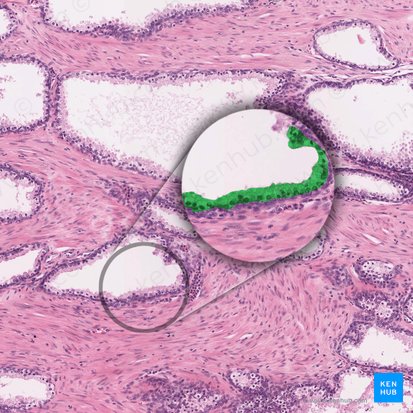 Epitélio colunar simples (Epithelium simplex columnare); Imagem: 