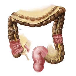 Intestino grosso