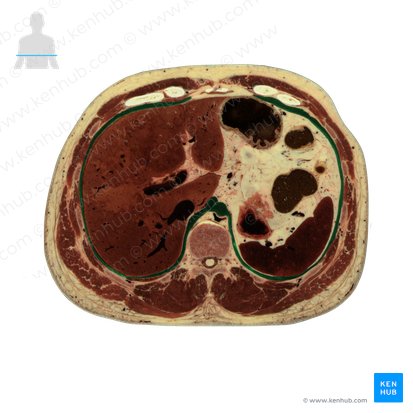 Diaphragma (Zwerchfell); Bild: National Library of Medicine