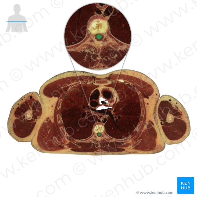 Medula espinal (Medulla spinalis); Imagem: National Library of Medicine