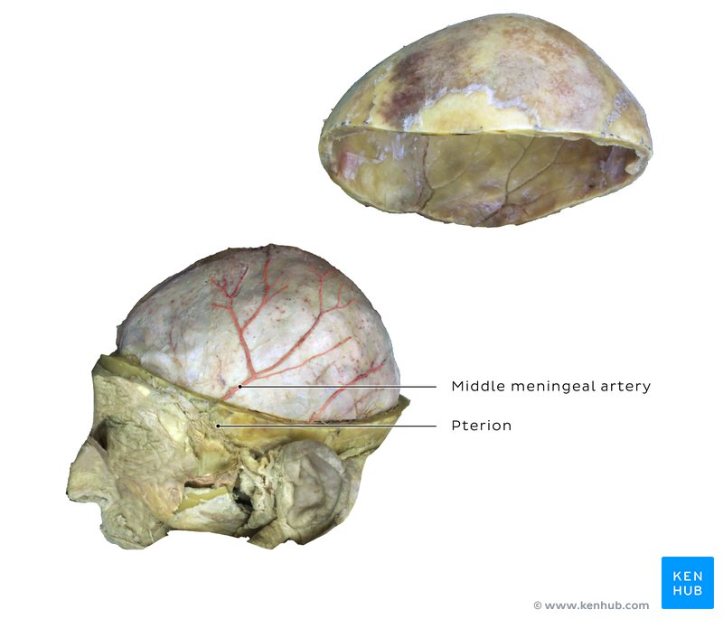 Pterion and middle meningeal artery - cadaveric image