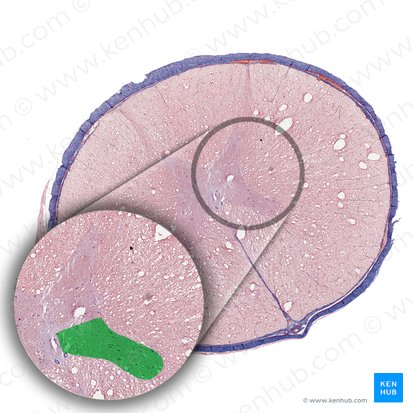 Corno anterior da medula espinal (Cornu anterius medullae spinalis); Imagem: 