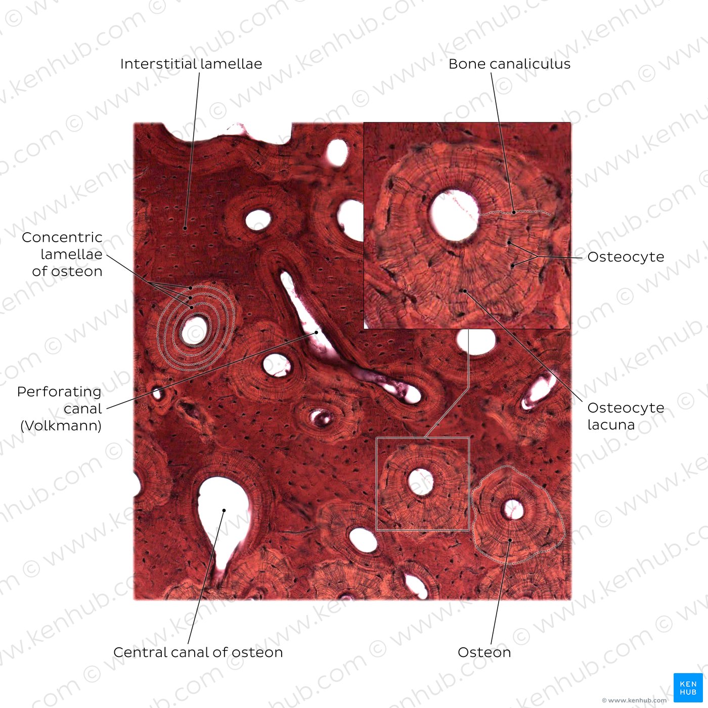 Compact bone. Stain: silver stain. Medium magnification