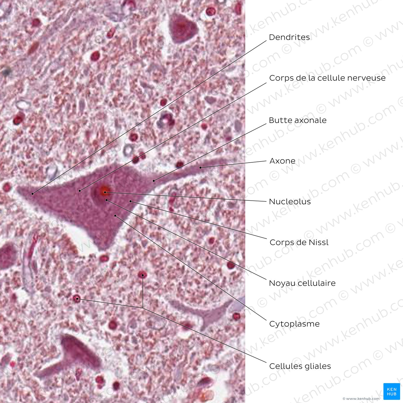 Multipolar neuron