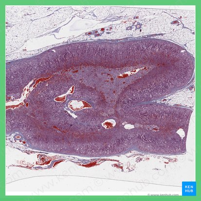 Suprarenal gland (Glandula suprarenalis); Image: 