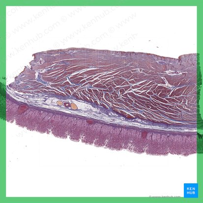 Pylorus; Image: 