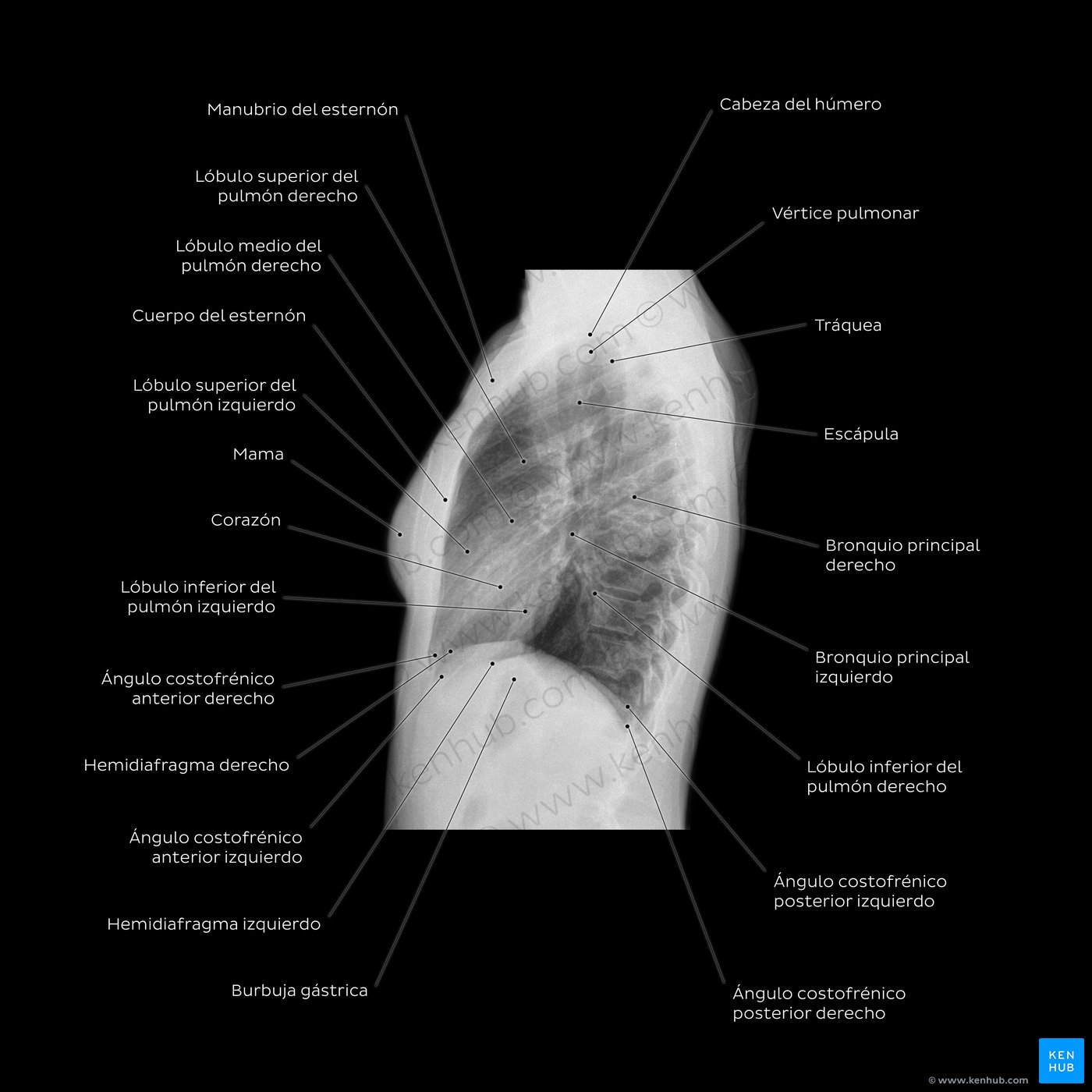 Radiografía normal de tórax (Rx): Proyección lateral