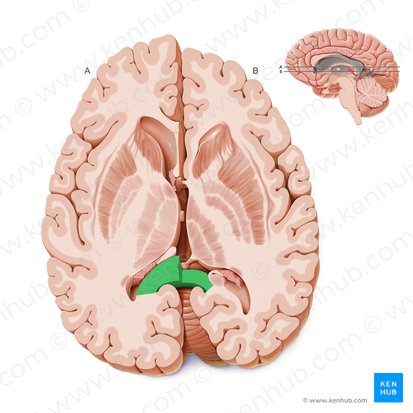 Splenium of corpus callosum (Splenium corporis callosi); Image: Paul Kim