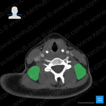 Musculus levator scapulae (Schulterblattheber); Bild: 