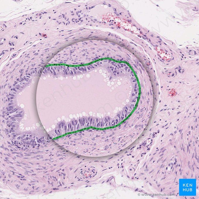 Miofibroblastos (Myofibroblasti); Imagen: 
