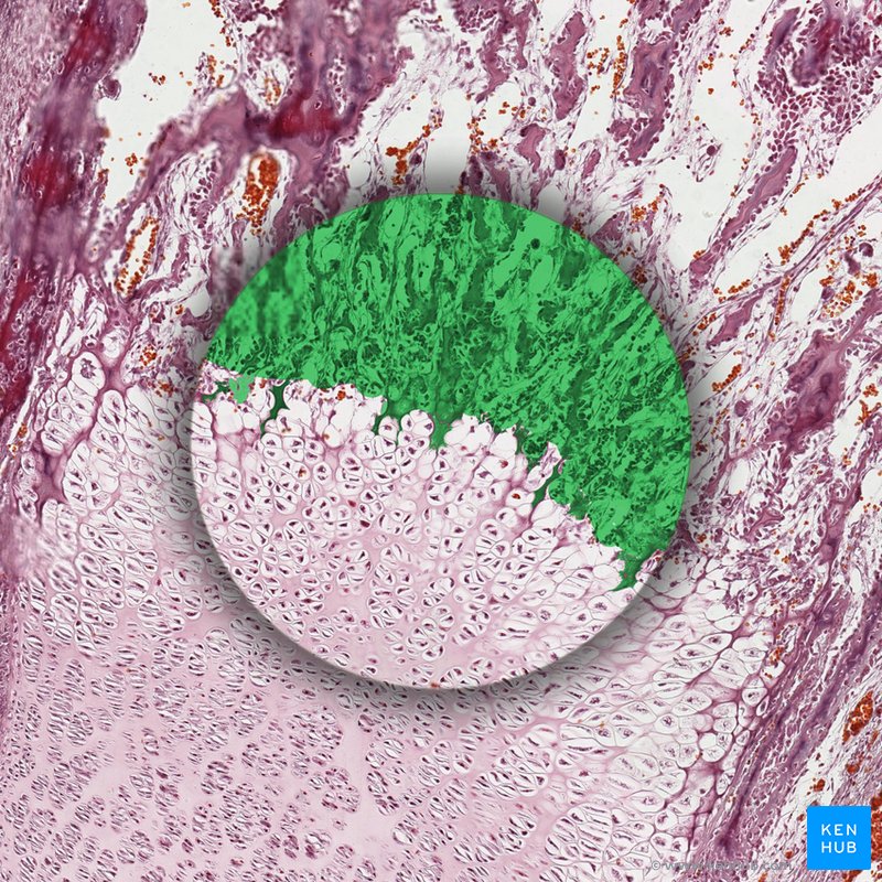 Bone matrix (histological slide)