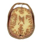 Caudate nucleus level