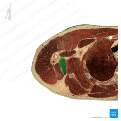 Teres major muscle (Musculus teres major); Image: National Library of Medicine