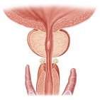Prostate