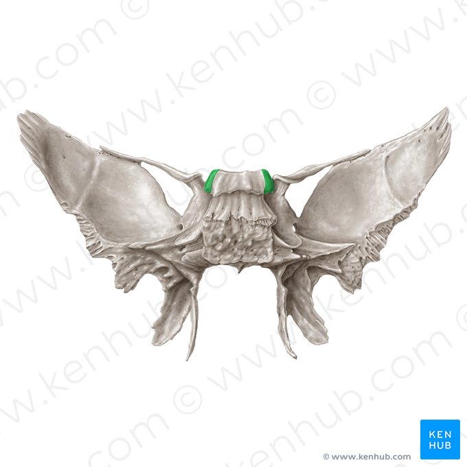 Processus clinoideus posterior ossis sphenoidalis (Hinterer Klinoidfortsatz des Keilbeins); Bild: Samantha Zimmerman