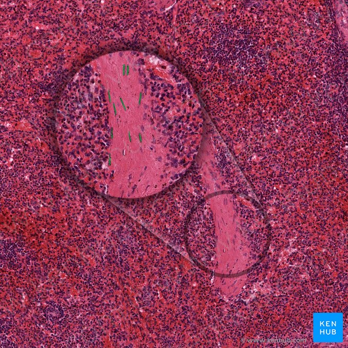 Miofibroblastos (Myofibroblasti); Imagen: 