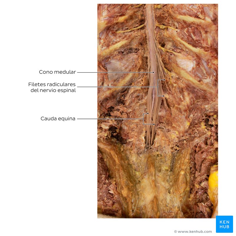 Cauda equina in a cadaver