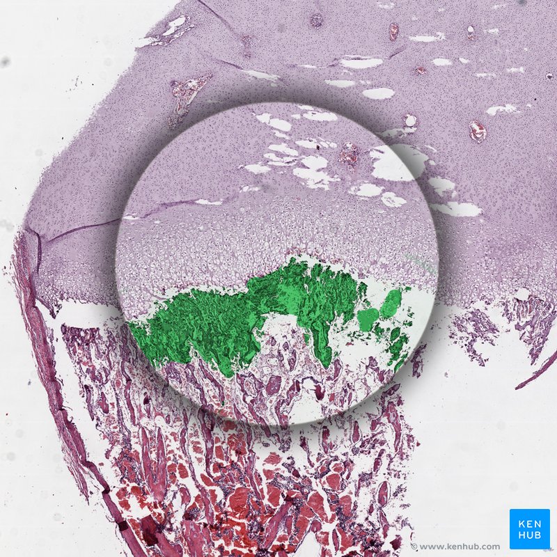 Zone of calcified cartilage - histological slide