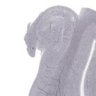 Hippocampusregion