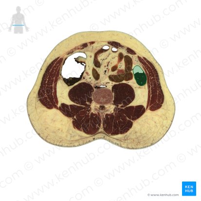 Descending colon (Colon descendens); Image: National Library of Medicine