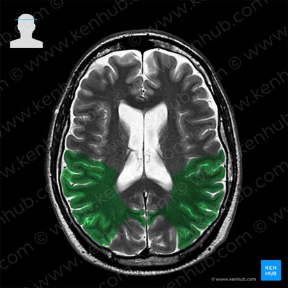 Lóbulo parietal (Lobus parietalis); Imagen: 