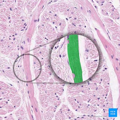 Sarcoplasm (Sarcoplasma); Image: 