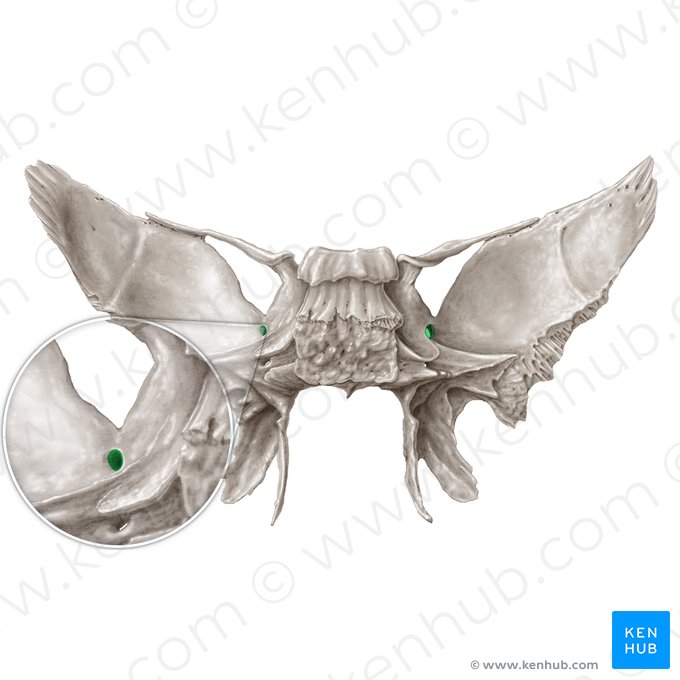 Forame redondo (Foramen rotundum); Imagem: Samantha Zimmerman