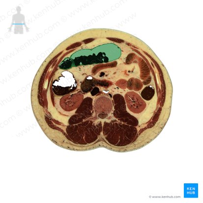Colon transverso (Colon transversum); Imagen: National Library of Medicine