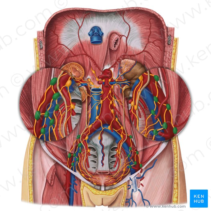 Nodi lymphoidei iliaci externi (Äußere Beckenlymphknoten); Bild: Irina Münstermann