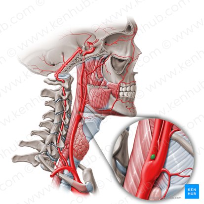 Carotid body (Glomus caroticum); Image: Paul Kim