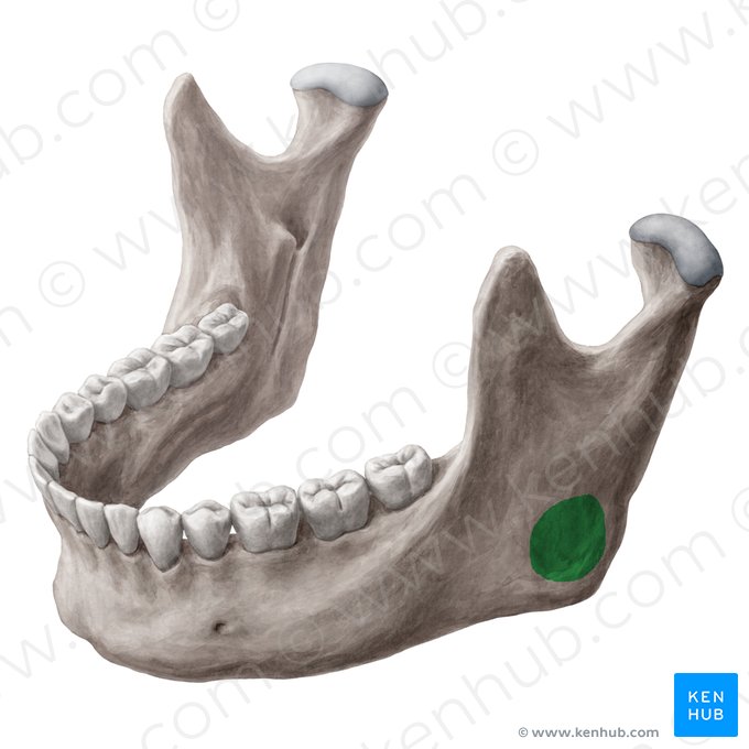 Tuberositas masseterica mandibulae (Kaumuskel-Rauigkeit des Unterkieferknochens); Bild: Yousun Koh