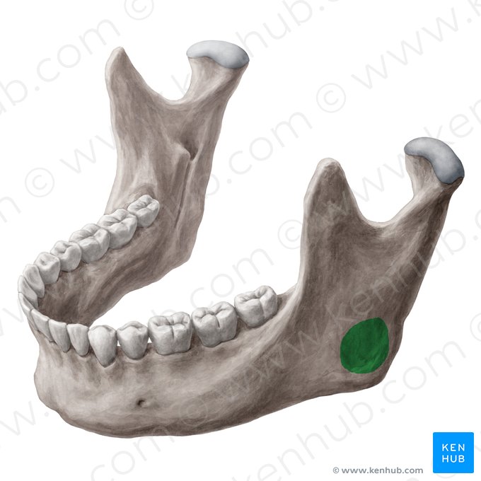 Tuberosidade massetérica da mandíbula (Tuberositas masseterica mandibulae); Imagem: Yousun Koh