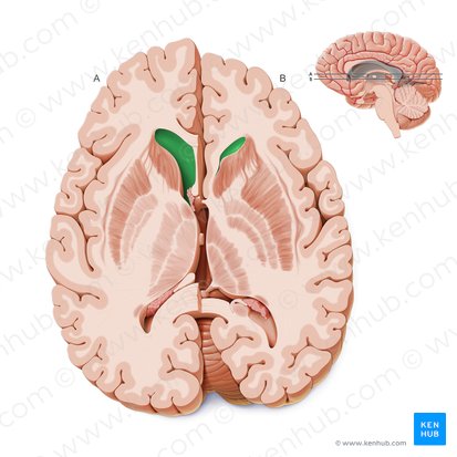 Asta frontal del ventrículo lateral (Cornu frontale ventriculi lateralis); Imagen: Paul Kim