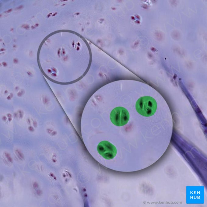 Groupe isogénique de chondrocytes (Aggregatio isogenica chondrocyti); Image : 