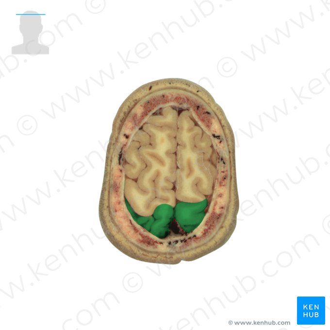 Lobo parietal (Lobus parietalis); Imagem: National Library of Medicine