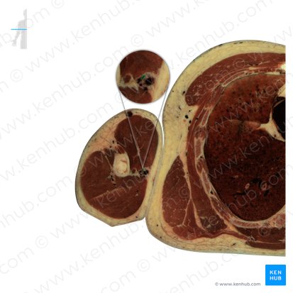 Arteria braquial (Arteria brachialis); Imagen: National Library of Medicine