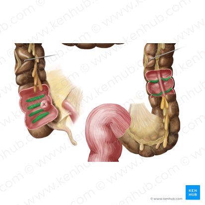 Plicae semilunares coli (Halbmondfalten des Dickdarms); Bild: Begoña Rodriguez