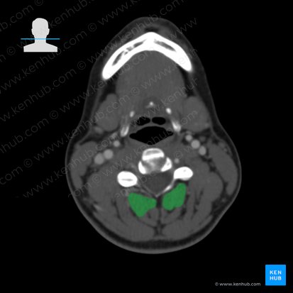 Multifidus muscle (Musculus multifidus); Image: 