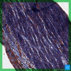 Straffes Bindegewebe - Histologie